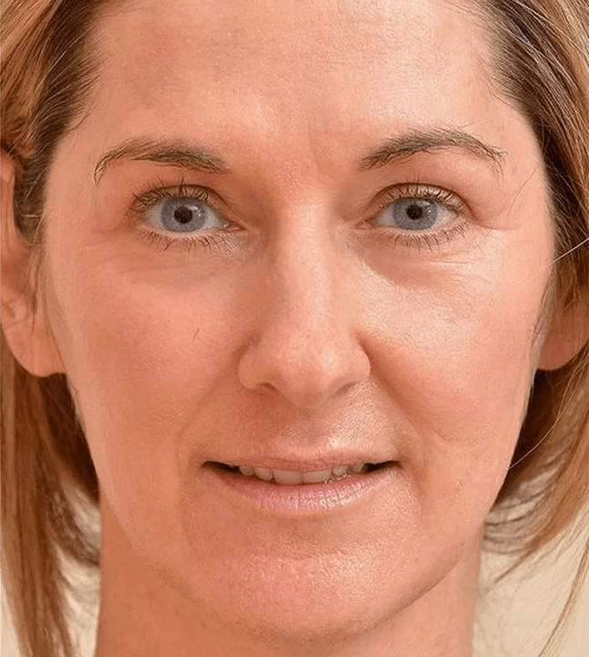 Po použití krému Eudalie vypadám mladší